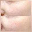 فوم ژل شستشوی صورت سنسیبیو بایودرما مخصوص پوست حساس و خشک 🎀| Bioderma Sensibio Gel moussant