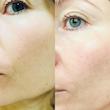 فوم ژل شستشوی صورت سنسیبیو بایودرما مخصوص پوست حساس و خشک 🎀| Bioderma Sensibio Gel moussant