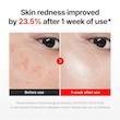 مادکا کرم ضدچروک، تسکین دهنده، ترمیم کننده و جوانساز سنتلین 24🍓| Centellian24 Madeca Cream Time Reverse