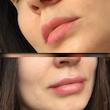ماسک لب شب توت فرنگی لانیژ اورجینال💓| Laneige Lip Sleeping Mask EX Berry 20g