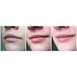 ماسک لب شب توت فرنگی لانیژ اورجینال💓| Laneige Lip Sleeping Mask EX Berry 20g
