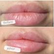 ماسک لب شب توت فرنگی لانیژ اورجینال💓| Laneige Lip Sleeping Mask EX Berry 20g