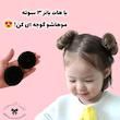 هات بانز (پروتز مو) 