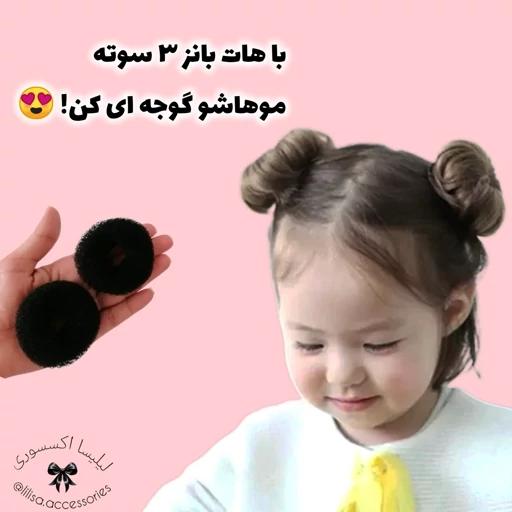 هات بانز (پروتز مو) 