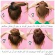 هات بانز (پروتز مو) 