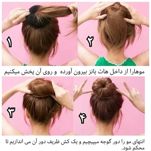 هات بانز (پروتز مو) 