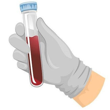 PRP در زخم 