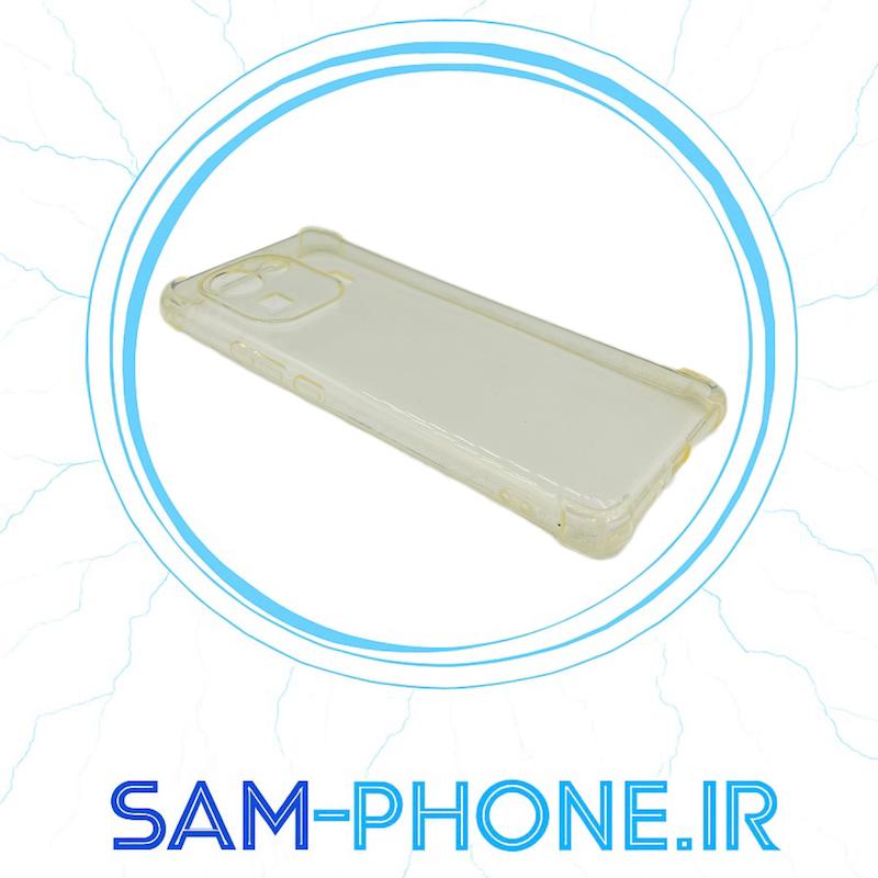 قاب گوشی Mi 11 Pro شیائومی اورجینال شفاف پشت شیشه ای محافظ لنزدار دار ایربگ دار کد 10927