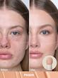 کانسیلر پد دار مدل Complexion Boost شیگلم 