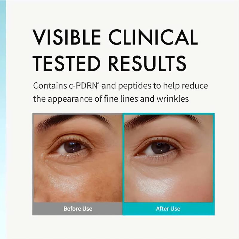 کرم دور چشم آنوا PDRN Caffeine با اپلیکاتور فلزی خنک کننده