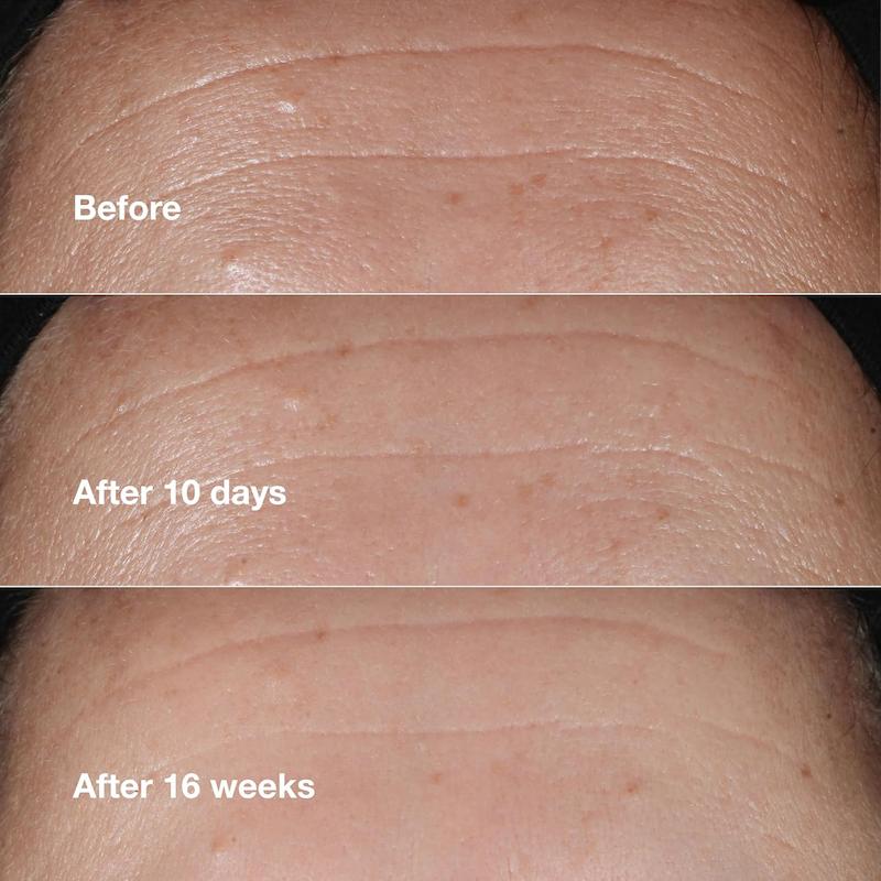 Clinique Smart Clinical Repair Wrinkle Correcting Serum 50ml کاهش قابل مشاهده خطوط و چروک