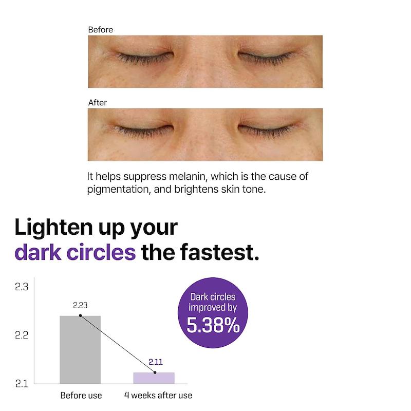 SOME BY MI Retinol Intense Advanced Triple Action Eye Cream 30ml نتایج روشن شدن تیرگی دور چشم