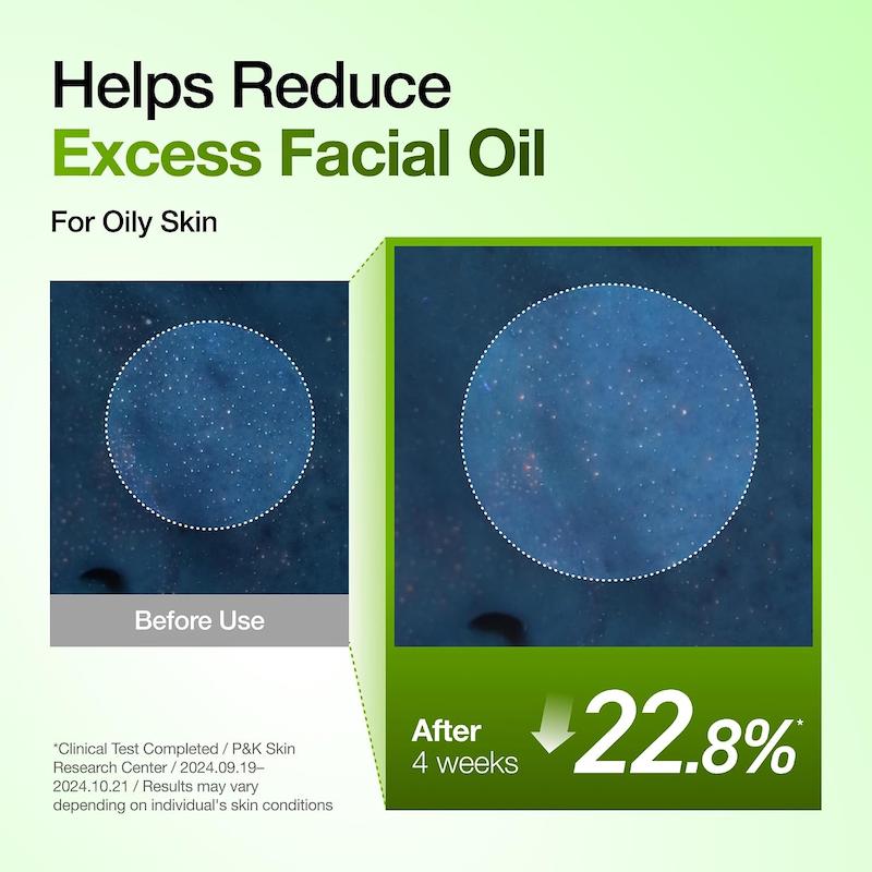 Anua Azelaic Acid 10 Hyaluron Redness Soothing Serum 30ml آبرسانی و ترکیبات موثر فرمول