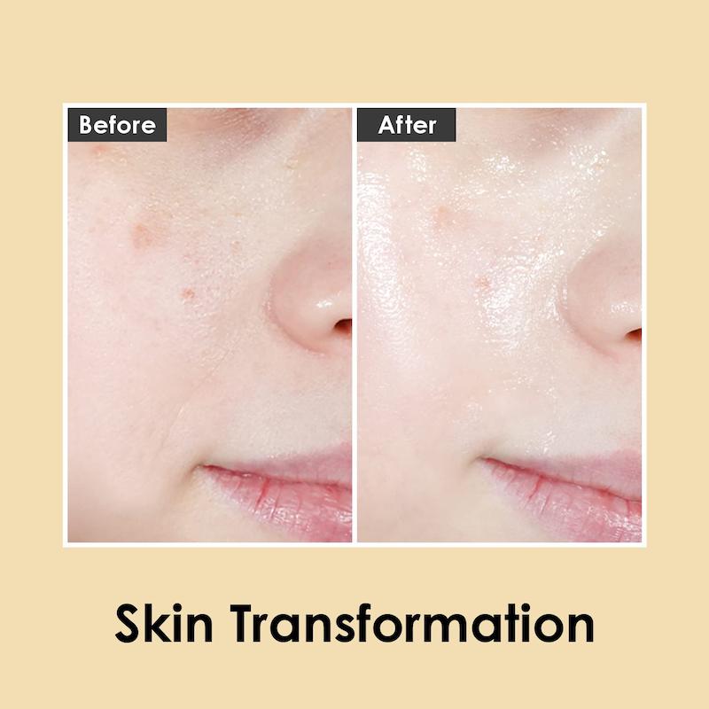 بطری آمپول MEDIPEEL Luxury 24K Gold روی پوست قبل و بعد استفاده محصول