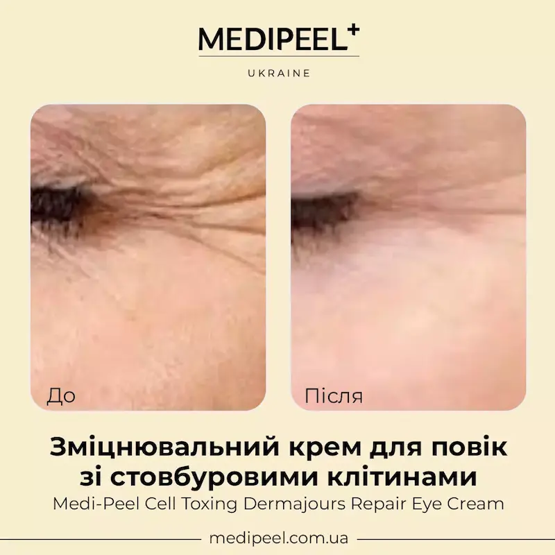 نمایش کرم دور چشم MEDIPEEL Cell Toxing Dermajours Repair Eye Cream روی پوست اطراف چشم