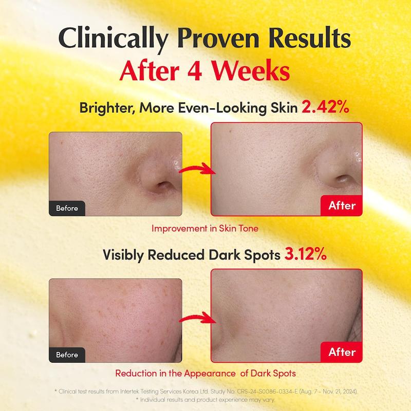 نتایج استفاده از EQQUALBERRY Deep Cera Vitamin Illuminating Serum برای بهبود ظاهر لک و تیرگی پوست