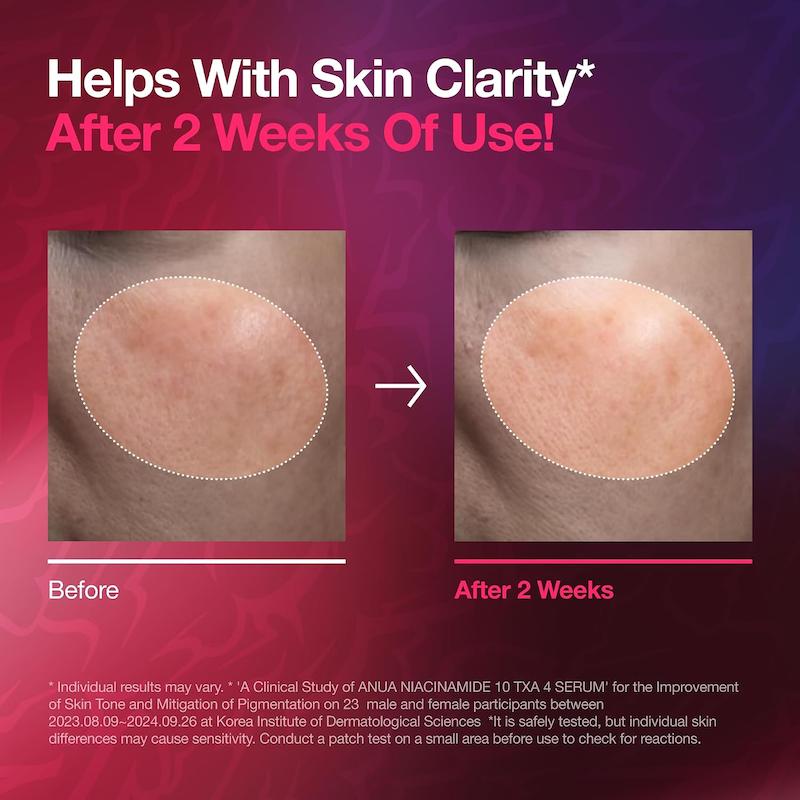 5. ترکیبات و مزایای سرم ANUA Niacinamide 10 TXA 4 شامل نیاسینامید، ترانگزامیک اسید و آربوتین