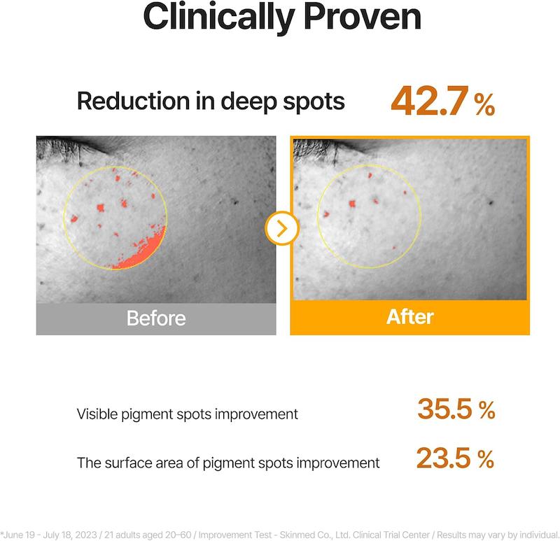 نتایج بالینی سرم Celimax Pore+Dark Spot Brightening در بهبود ظاهر لک‌های عمیق و تیرگی‌های پوست