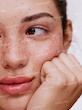 تینت Freck Please Freckle شیگلم