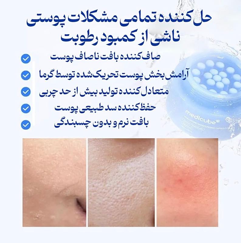 کرم کپسولی هیالورونیک اسید مدی کیوب – آبرسان عمیق پوست / Medicube