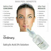 سرم سالیسیلیک اسید %2 اوردینری (The Ordinary) | ضدجوش و لایه بردار