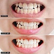 خمیردندان سفیدکننده Dental IQ مدیان 