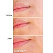 پچ جوش موضعی Clear Spot سامبایمی 
