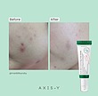 سرم Dark Spot Correcting Glow اکسیس-وای