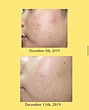 سرم Dark Spot Correcting Glow اکسیس-وای