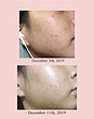 سرم Dark Spot Correcting Glow اکسیس-وای