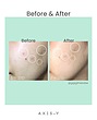 سرم Dark Spot Correcting Glow اکسیس-وای