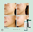 سرم Dark Spot Correcting Glow اکسیس-وای