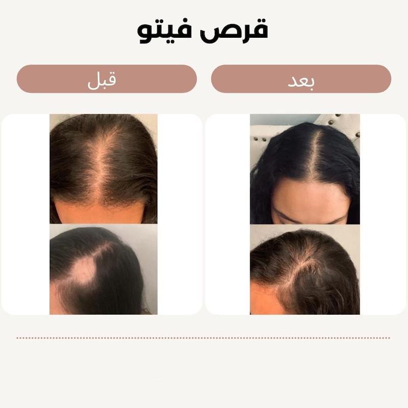 قرص فیتو اورجینال