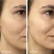 تونر آبرسان و درخشان کننده سنتلا هیالو سیکا اسکین 1004( Centella Hyalu-Cica Brightening Toner)