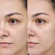  تونر آبرسان هیالورونیک اسید پلاس ایزنتری (ISNTREE Hyaluronic Acid Toner Plus 200ml)