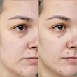  تونر آبرسان هیالورونیک اسید پلاس ایزنتری (ISNTREE Hyaluronic Acid Toner Plus 200ml)