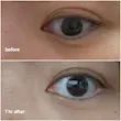 کرم دور چشم دکتر ملاکسین مدلTX (Dr.Melaxin TX Retinalsome Double Effect Eye Cream)
