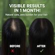 صابون شامپو ضد ریزش مو گرین لم (Green Lamb Anti-Hair Loss Shampoo Soap)