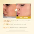 تونر کوجیک اسید kojic acid مدیکیوب medicube 