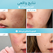 پک ماسک ب5 و هیالو اسید ضد التهاب و تسکین دهنده نامبوزین Numbuzin NO1 SHEET MASK PANTOTHENIC B5 HYALURONIC ACTIVE CLEAR MASK
