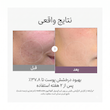 کرم کپسولی جوانساز و روشن کننده گلوتاتیون مدیکیوب medicube age-r glutathione glow capsule cream