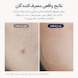 تونر لایه‌ بردار گلیکولیک اسید آرنسیا Arencia Eraser Shot Glycolic Acid Exfoliator