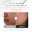 كرم ترميم كننده وتسكين دهنده ٣H مدی کیوب/مدیکیوب Medicube H Daily Relief Cream