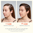 سرم اسکالپ محرک رشد مو لیلیوئه lilyeve GROWTURN Hair Growth Serum