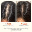 سرم اسکالپ محرک رشد مو لیلیوئه lilyeve GROWTURN Hair Growth Serum