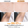 اسپری پیل شات کوجیک اسید و زردچوبه لایه بردار و روشن کننده بدن دکتر ملاکسین Dr.Melaxin Peel Shot Keratin Care Kojic Acid Turmeric Spray