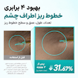 کرم دور چشم PDRN و کافئین ضدپف، ضدچروک و جوانساز آنوا ANUA PDRN + Caffeine Rejuvenating Eye Cream