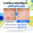 پد دوطرفه متعادل کننده آزلا و سیکا ضدجوش نامبوزین numbuzin No.0 Zero Blemish Azela Cica Balancing Dual Pads