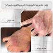 کرم مراقبت و بازسازی پوست حساس سیکالفیت اون برند اون