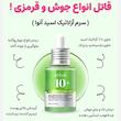  جزئیات سبک سرم آزلائیک اسید و هیالورون مناسب آبرسانی پوست برند آنوا